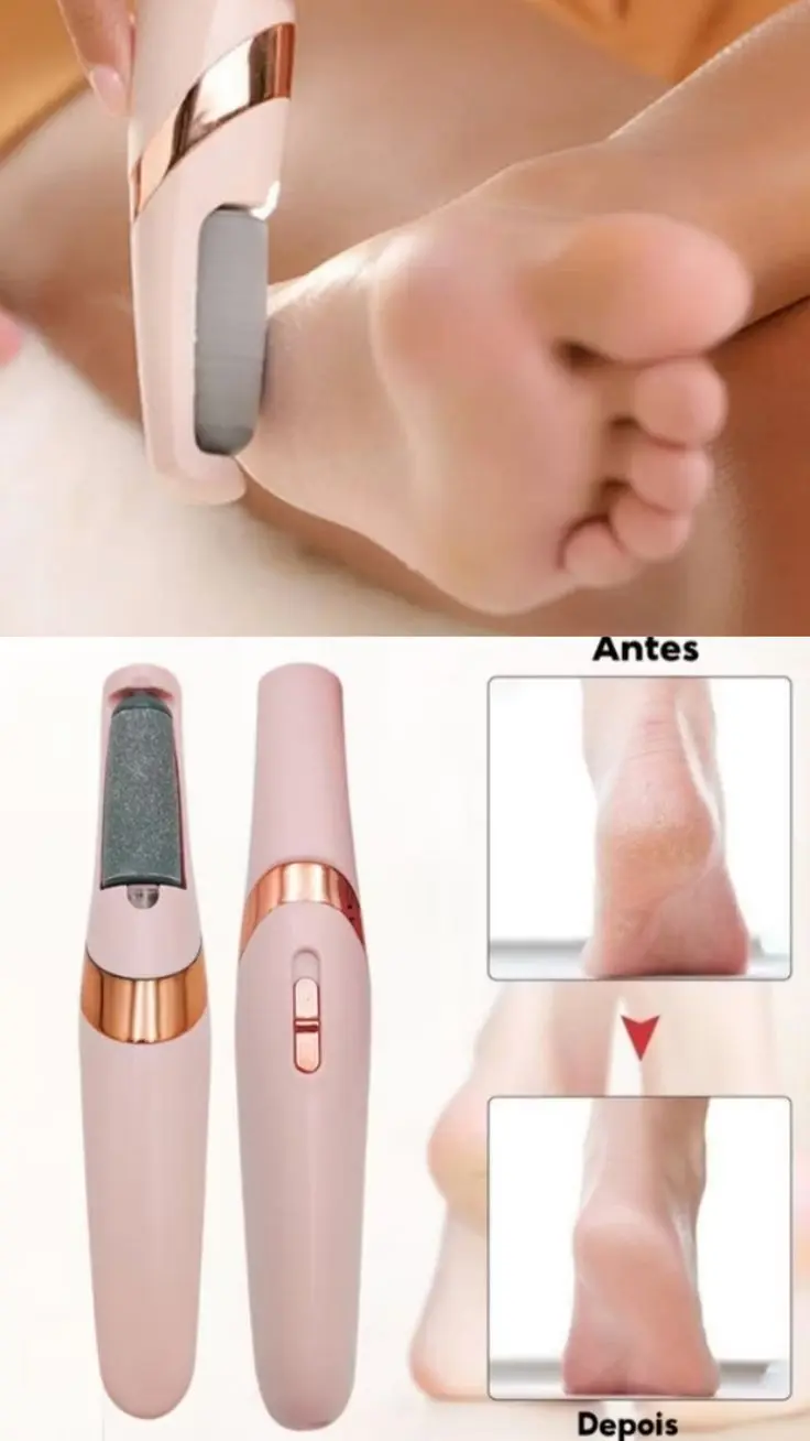 Electric Foot Callus Remover | USB Rechargeable Pedicure Tool